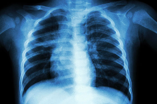 x-ray-istock-globaltechmagazine